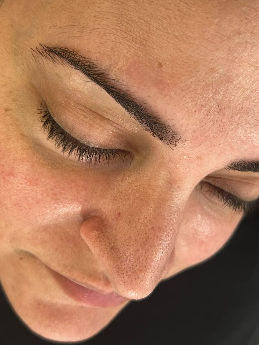 Brow detail after treatment at Nourél Beauty Center