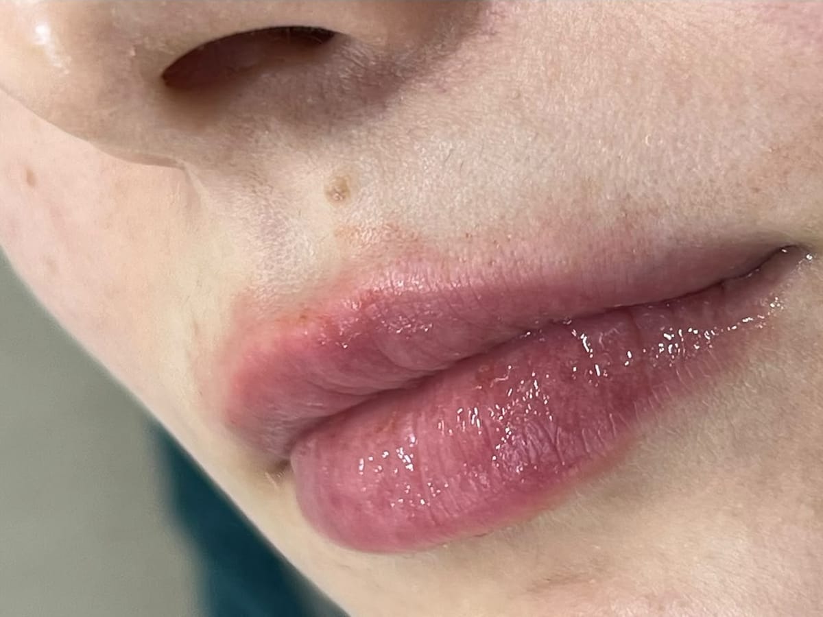 Soft, hydrated lips after lip care at Nourél