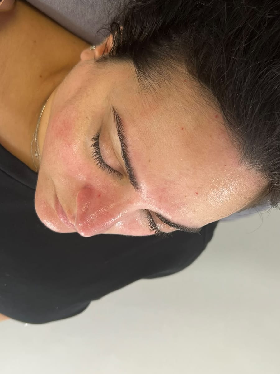 Calm skin after a facial