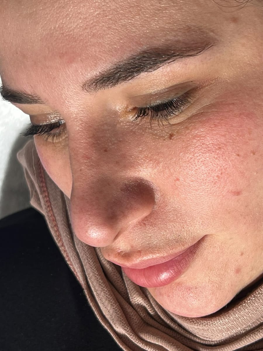 Fresh, glowing skin after a facial at Nourél Beauty Center