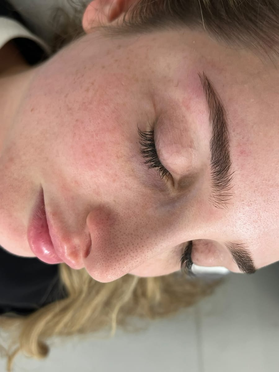 Radiant skin after a treatment at Nourél Beauty Center